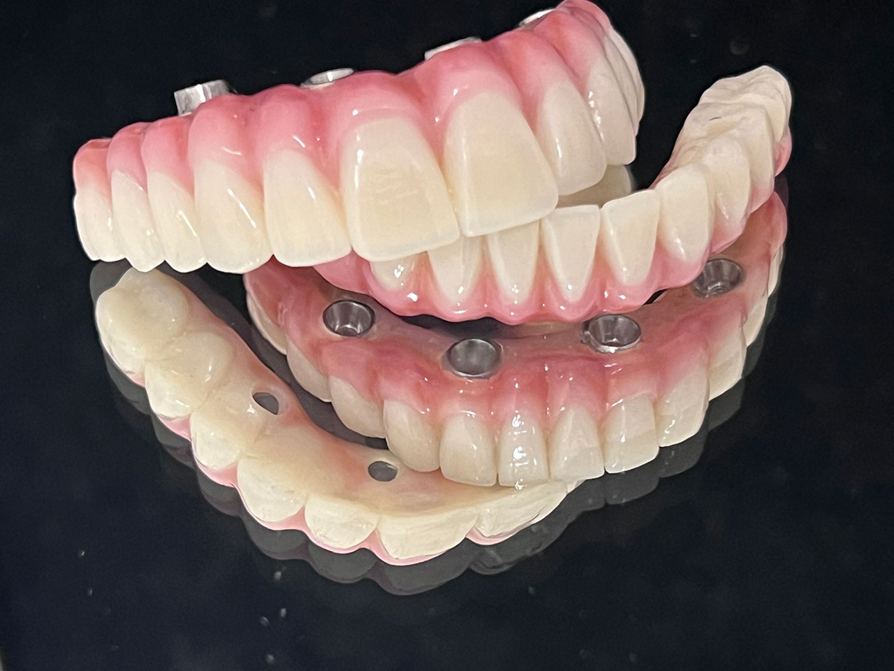 izrada protetičkih radova