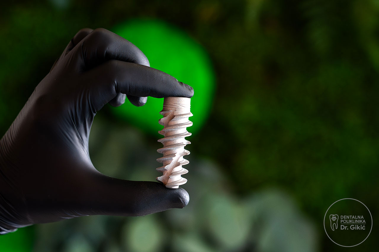 Što su zubni implantati