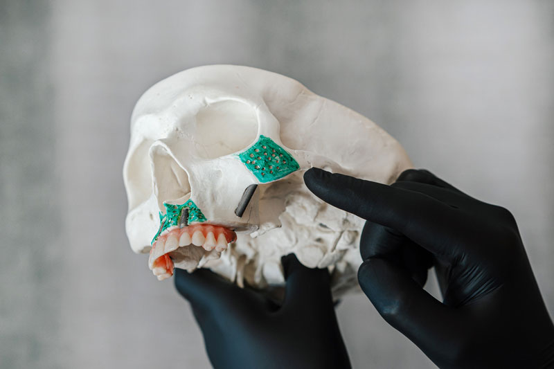zygoma
